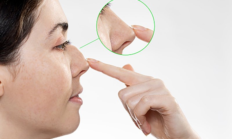 Kvinneansikt med fokus på nesekorreksjon