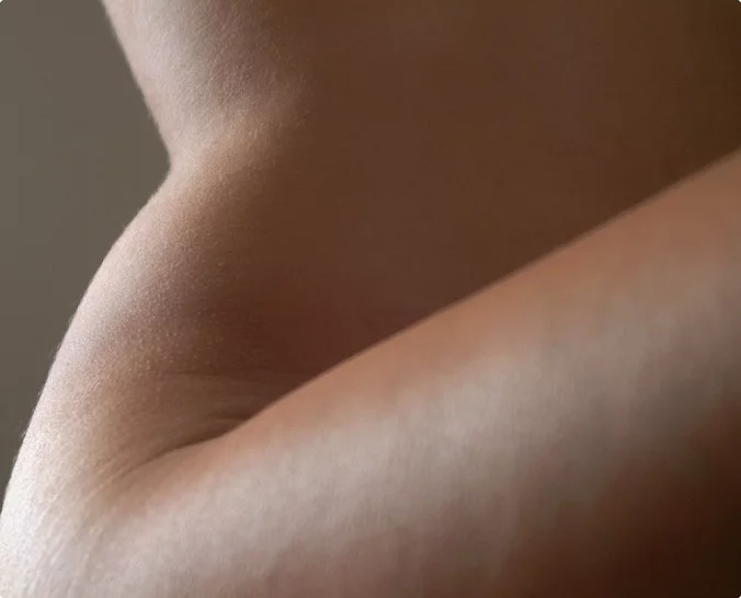 Modell for lårplastikk hos Asteta Clinic