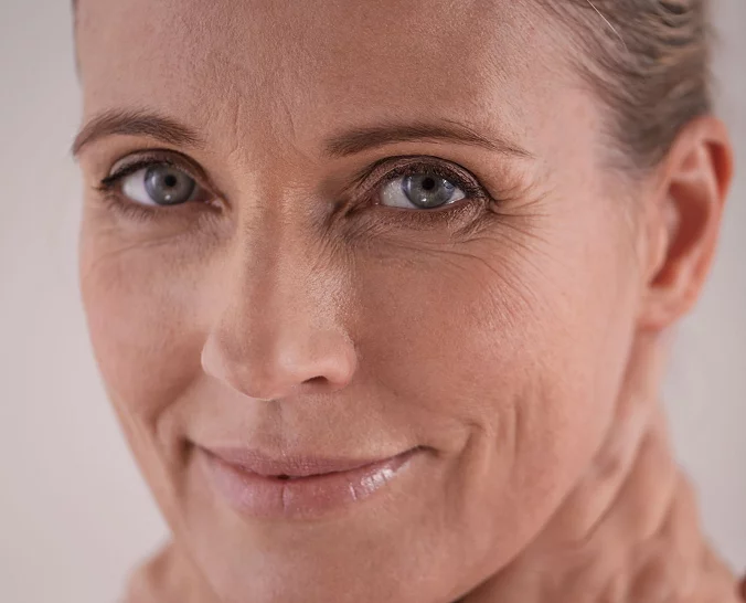 Voksen kvinnelig modell for poser under øynene Asteta Clinic