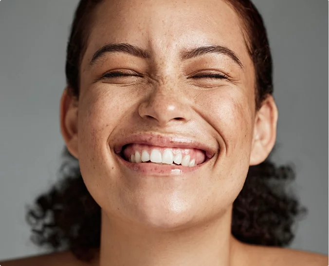Ung kvinnelig modell for skinbooster hos Asteta Clinic