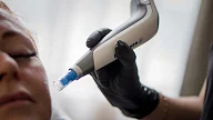 Celine hos Asteta Clinic behandler med Dermapen - nærbilde