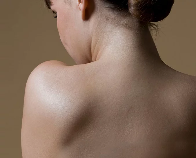 Rygg til kvinnelig modell for plastisk kirurgi